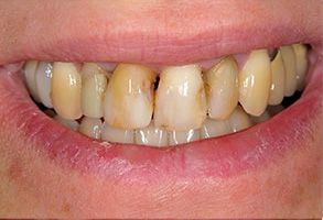 Eastern Pines Dental | Dental Implants, Sedation Dentistry and Same Day Crowns