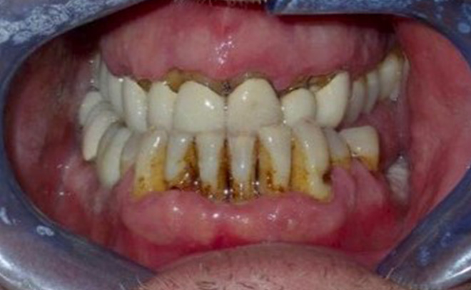 Eastern Pines Dental | Sedation Dentistry, Botox® Treatments for Jaw Pain and Cosmetic Dentistry