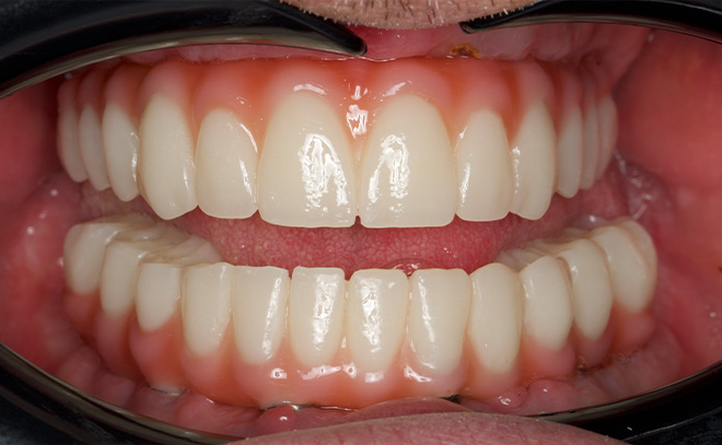 Eastern Pines Dental | Oral Surgery, Sleep Apnea and Same Day Crowns