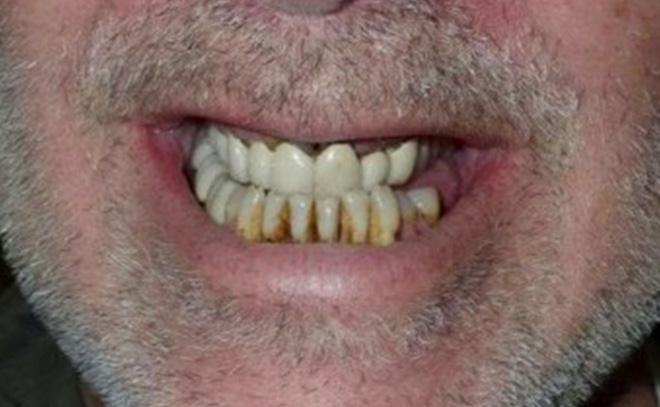 Eastern Pines Dental | Oral Surgery, Dental Implants and Cosmetic Dentistry