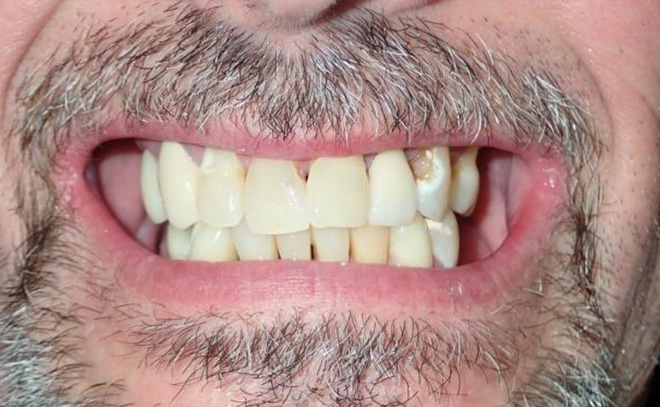 Eastern Pines Dental | Sedation Dentistry, Botox® Treatments for Jaw Pain and Cosmetic Dentistry