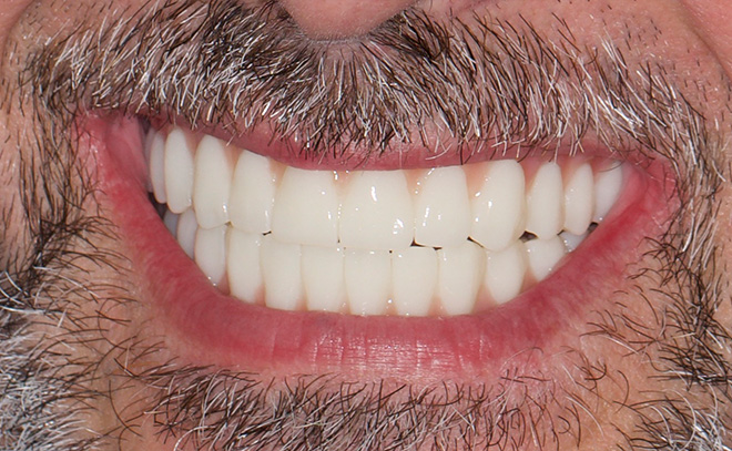 Eastern Pines Dental | Oral Surgery, Sleep Apnea and Same Day Crowns