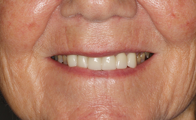 Eastern Pines Dental | Oral Surgery, Sleep Apnea and Same Day Crowns