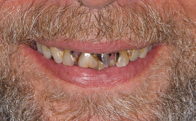 Eastern Pines Dental | Sedation Dentistry, Botox reg  Treatments for Jaw Pain and Cosmetic Dentistry