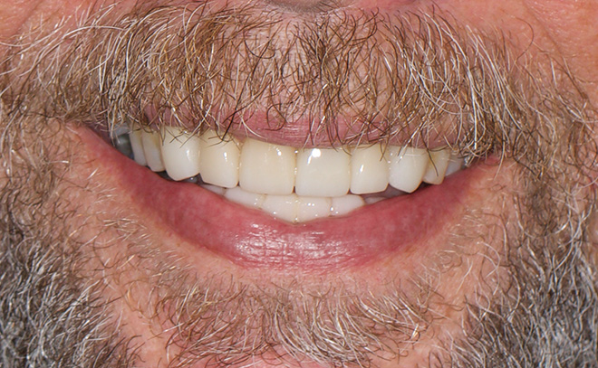 Eastern Pines Dental | Oral Surgery, Sleep Apnea and Same Day Crowns