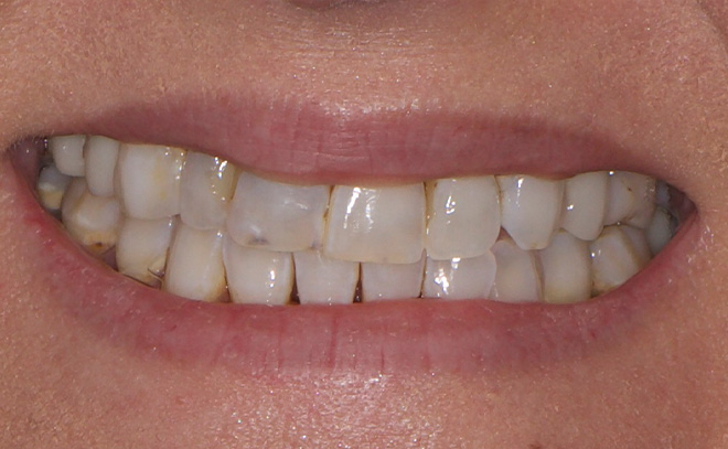 Eastern Pines Dental | Sedation Dentistry, Botox reg  Treatments for Jaw Pain and Cosmetic Dentistry