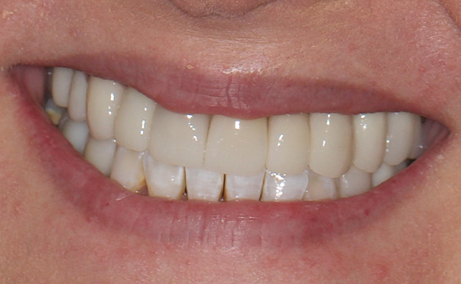 Eastern Pines Dental | Oral Surgery, Sleep Apnea and Same Day Crowns