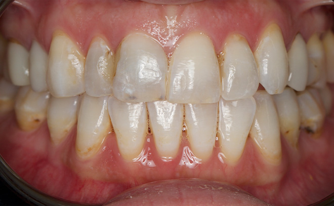 Eastern Pines Dental | Oral Surgery, Dental Implants and Cosmetic Dentistry