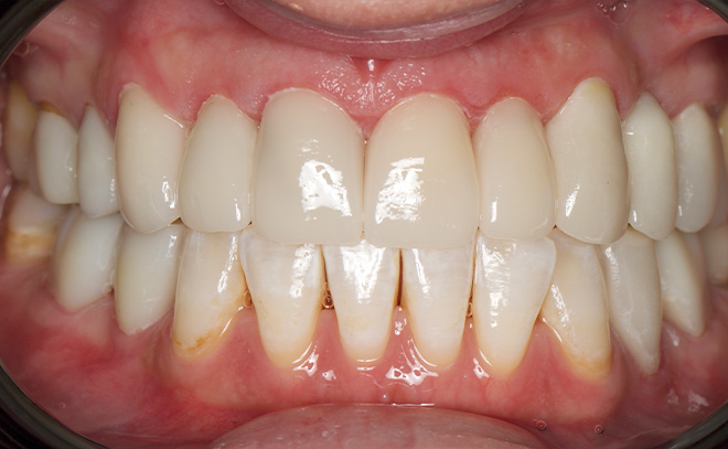 Eastern Pines Dental | Sleep Apnea, Botox reg  Treatments for Jaw Pain and All-on-X Hybrid Dentures