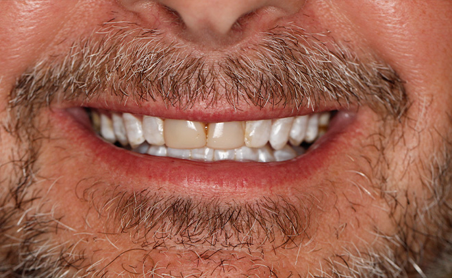 Eastern Pines Dental | Sedation Dentistry, Botox reg  Treatments for Jaw Pain and Cosmetic Dentistry