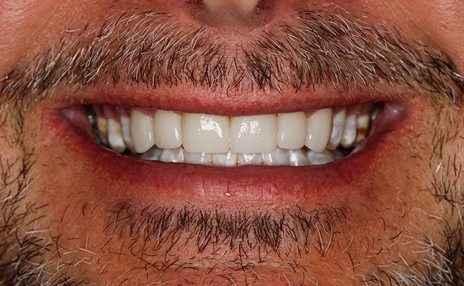 Eastern Pines Dental | Oral Surgery, Sleep Apnea and Same Day Crowns