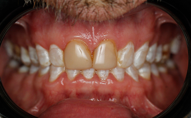 Eastern Pines Dental | Oral Surgery, Dental Implants and Cosmetic Dentistry