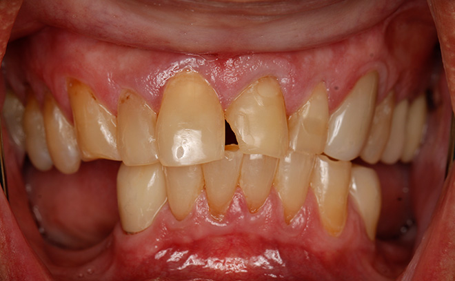 Eastern Pines Dental | Sedation Dentistry, Botox reg  Treatments for Jaw Pain and Cosmetic Dentistry