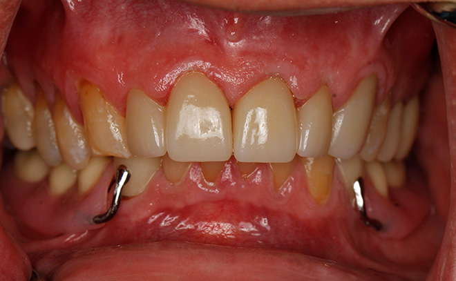 Eastern Pines Dental | Oral Surgery, Sleep Apnea and Same Day Crowns