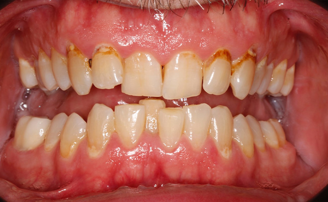 Eastern Pines Dental | Sedation Dentistry, Botox reg  Treatments for Jaw Pain and Cosmetic Dentistry