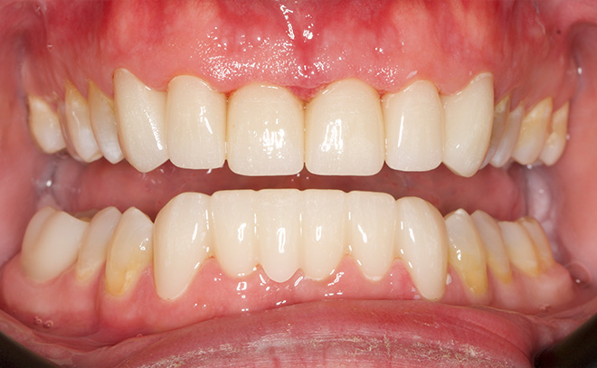 Eastern Pines Dental | Oral Surgery, Sleep Apnea and Same Day Crowns