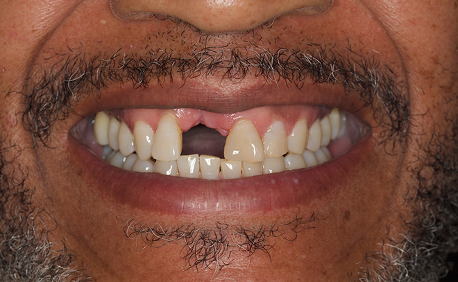 Eastern Pines Dental | Sedation Dentistry, Botox® Treatments for Jaw Pain and Cosmetic Dentistry