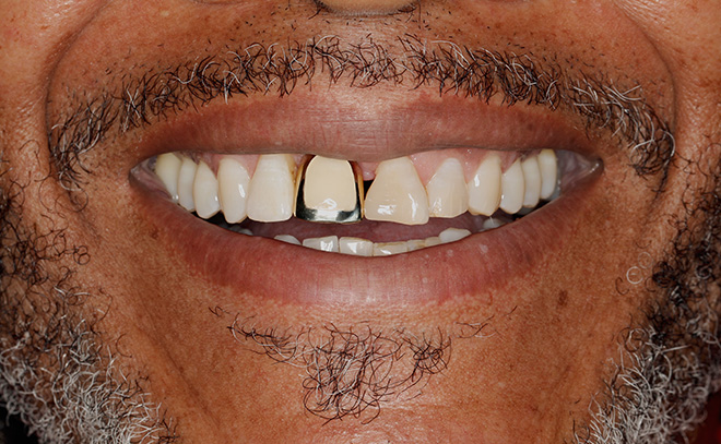 Eastern Pines Dental | Oral Surgery, Sleep Apnea and Same Day Crowns