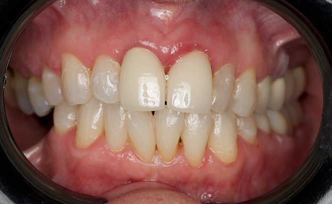 Eastern Pines Dental | Sedation Dentistry, Botox® Treatments for Jaw Pain and Cosmetic Dentistry