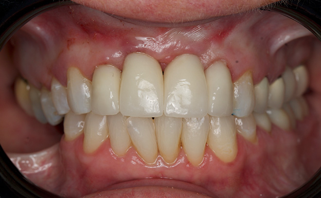 Eastern Pines Dental | Oral Surgery, Sleep Apnea and Same Day Crowns