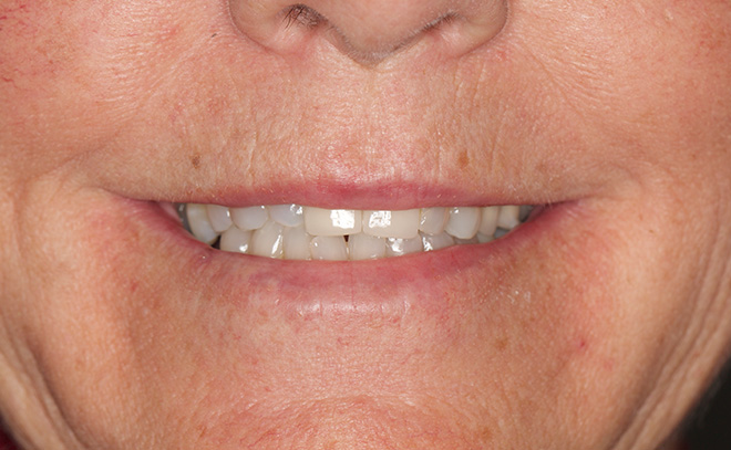 Eastern Pines Dental | Oral Surgery, Dental Implants and Cosmetic Dentistry