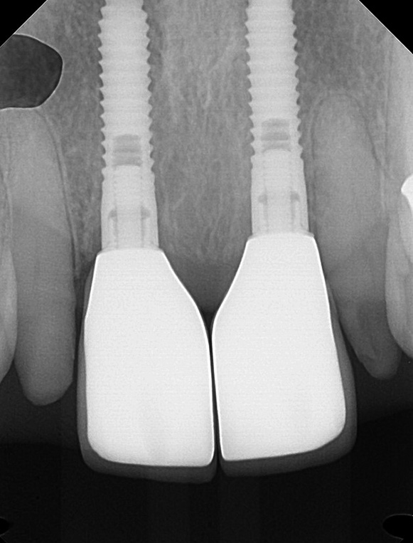 Eastern Pines Dental | Cosmetic Dentistry, Sleep Apnea and Botox® Treatments for Jaw Pain