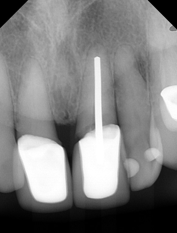 Eastern Pines Dental | Botox® Treatments for Jaw Pain, Cosmetic Dentistry and Dental Implants