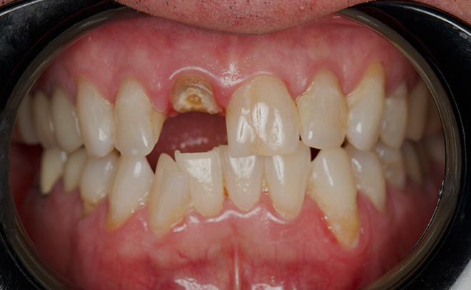 Eastern Pines Dental | Sedation Dentistry, Botox® Treatments for Jaw Pain and Cosmetic Dentistry