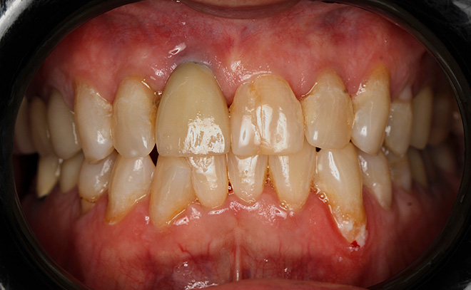 Eastern Pines Dental | Oral Surgery, Sleep Apnea and Same Day Crowns