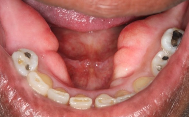 Eastern Pines Dental | Sedation Dentistry, Botox® Treatments for Jaw Pain and Cosmetic Dentistry