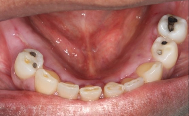 Eastern Pines Dental | Oral Surgery, Sleep Apnea and Same Day Crowns