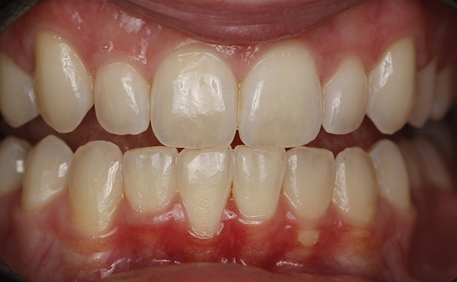 Eastern Pines Dental | Sedation Dentistry, Botox reg  Treatments for Jaw Pain and Cosmetic Dentistry