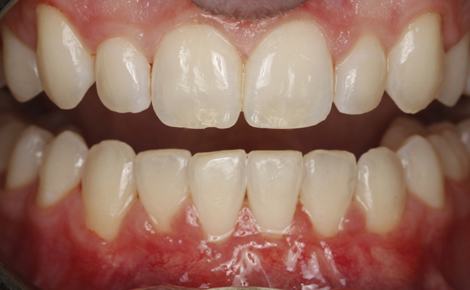 Eastern Pines Dental | Oral Surgery, Sleep Apnea and Same Day Crowns