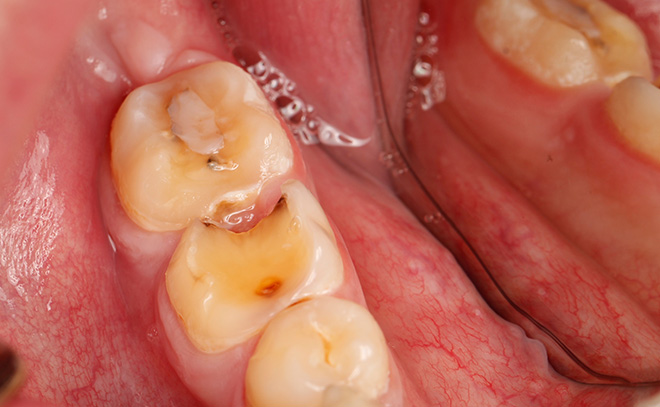 Eastern Pines Dental | Sedation Dentistry, Botox® Treatments for Jaw Pain and Cosmetic Dentistry