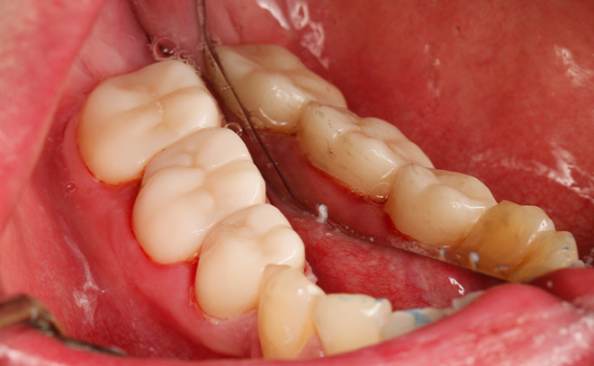 Eastern Pines Dental | Oral Surgery, Sleep Apnea and Same Day Crowns