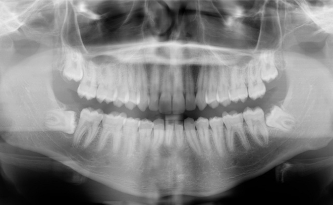 Eastern Pines Dental | Sedation Dentistry, Botox® Treatments for Jaw Pain and Cosmetic Dentistry