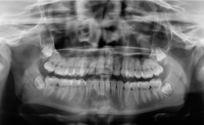 Eastern Pines Dental | Oral Surgery, Sleep Apnea and Same Day Crowns