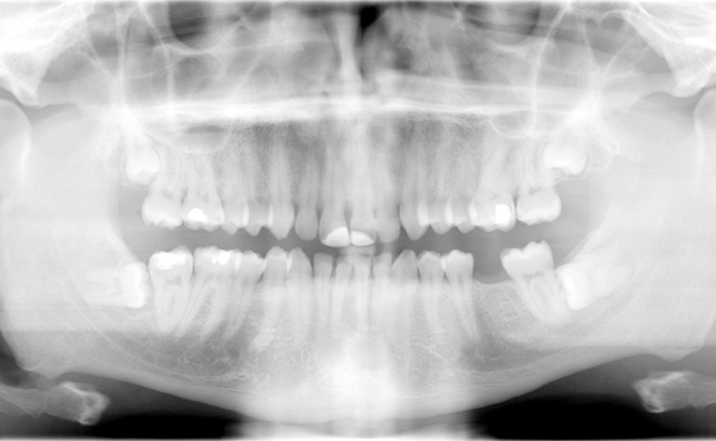 Eastern Pines Dental | Oral Surgery, Dental Implants and Cosmetic Dentistry